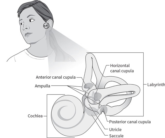 21+ großartig Bild Inner Ear Dizziness Exercises - Epley Maneuver Exercises For Vertigo Ent Clinic : It is used for people with dizziness from inner ear conditions such as vestibular neuritis.